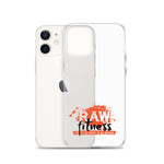 iPhone Case - LIFE IS TOO SHORT